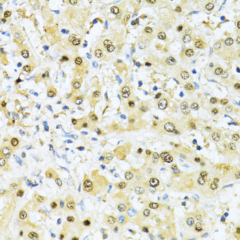 Immunofluorescence analysis of MCF-7 cells using TIMP3 Polyclonal Antibody