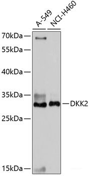 Immunofluorescence analysis of C6 cells using KSR1 Polyclonal Antibody at dilution of 1:100 (40x lens). Blue: DAPI for nuclear staining.