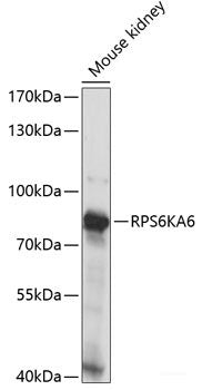Immunofluorescence analysis of U2OS cells using UBA3 Polyclonal Antibody at dilution of 1:100. Blue: DAPI for nuclear staining.