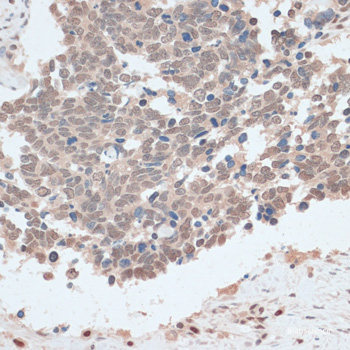 Immunofluorescence analysis of Mouse colon using GPA33 Polyclonal Antibody at dilution of 1:100. Blue: DAPI for nuclear staining.
