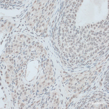 Immunofluorescence analysis of C6 cells using SEC23B Polyclonal Antibody at dilution of 1:100. Blue: DAPI for nuclear staining.