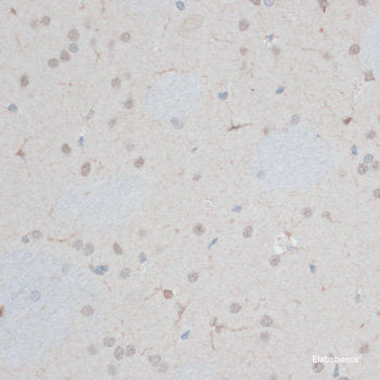 Western blot analysis of extracts of Mouse liver using MAP3K2 Polyclonal Antibody at dilution of 1:1000.