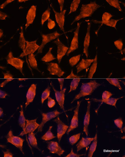 Immunohistochemistry of paraffin-embedded Human colon using CES2 Polyclonal Antibody at dilution of 1:100 (40x lens).