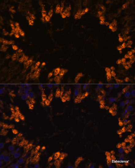 Immunofluorescence analysis of U2OS cells using NCAPH Polyclonal Antibody at dilution of 1:100. Blue: DAPI for nuclear staining.
