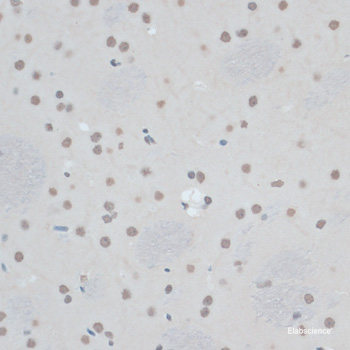 Western blot analysis of extracts of Mouse testis using RNF125 Polyclonal Antibody at dilution of 1:1000.