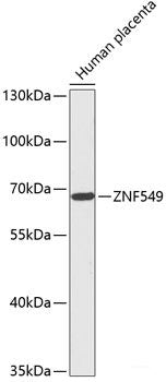Western blot analysis of extracts of HeLa cells using STRBP Polyclonal Antibody at dilution of 1:1000.