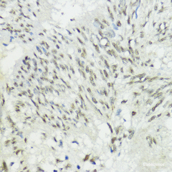 Western blot analysis of extracts of various cell lines using EIF4ENIF1 Polyclonal Antibody at dilution of 1:1000.