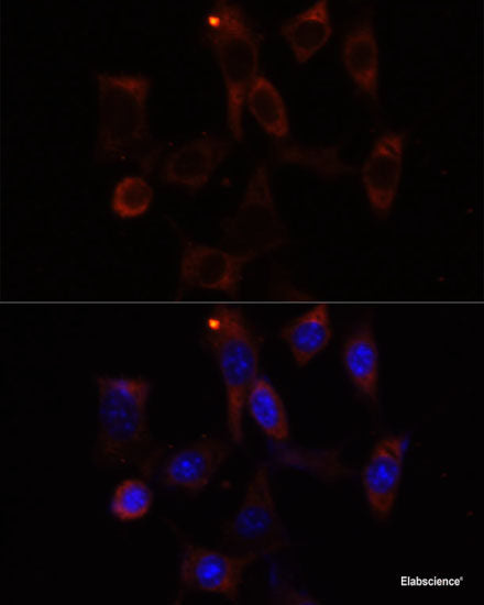 Immunofluorescence analysis of Rat brain using SLC17A6 Polyclonal Antibody at dilution of 1:100 (40x lens). Blue: DAPI for nuclear staining.