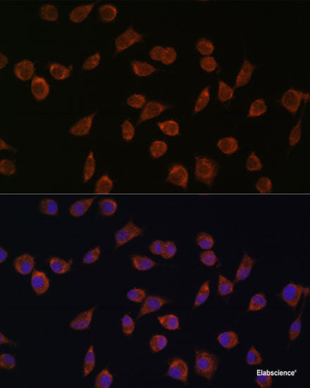 Immunofluorescence analysis of U2OS cells using MCCC2 Polyclonal Antibody at dilution of 1:100. Blue: DAPI for nuclear staining.