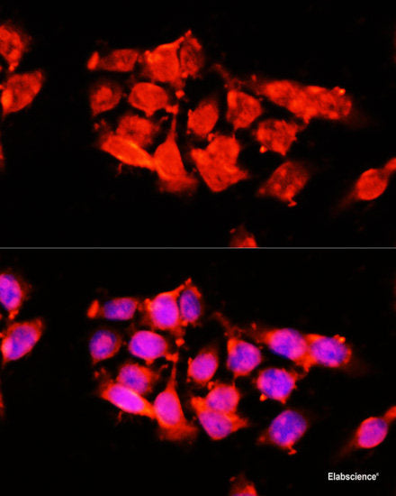 Immunofluorescence analysis of U2OS cells using TCTN2 Polyclonal Antibody at dilution of 1:100. Blue: DAPI for nuclear staining.