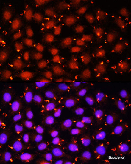Immunofluorescence analysis of U2OS cells using ARL6 Polyclonal Antibody at dilution of 1:100. Blue: DAPI for nuclear staining.