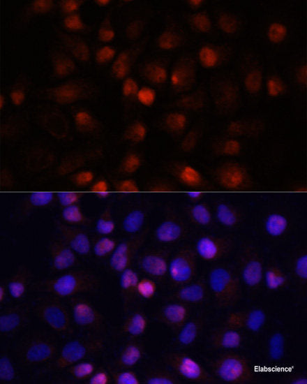 Immunohistochemistry of paraffin-embedded Rat brain using PRMT5 Polyclonal Antibody at dilution of 1:100 (40x lens).