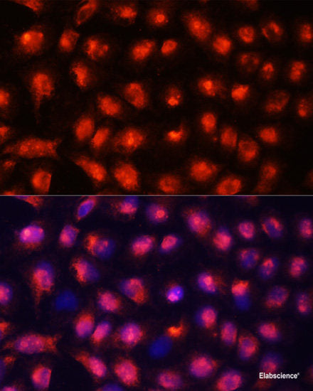 Immunofluorescence analysis of U2OS cells using ATG4C Polyclonal Antibody at dilution of 1:100. Blue: DAPI for nuclear staining.