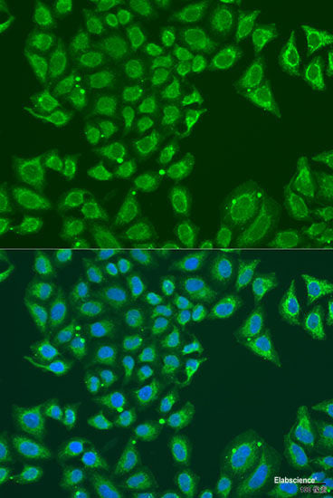 Immunofluorescence analysis of U-2 OS cells using UPF1 Polyclonal Antibody at dilution of 1:100. Blue: DAPI for nuclear staining.