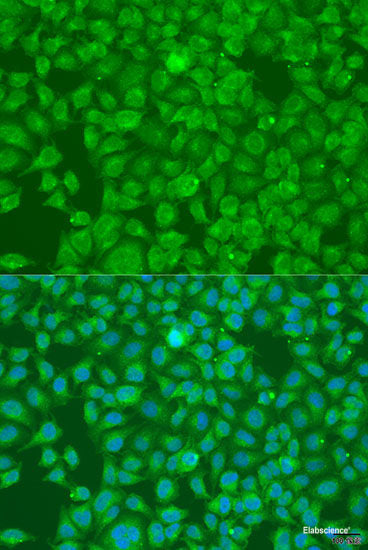 Western blot analysis of extracts of Mouse brain using FGD5 Polyclonal Antibody at dilution of 1:1000.