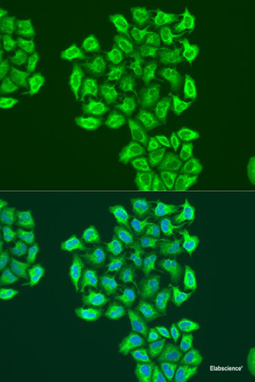 Immunofluorescence analysis of Hela cells using SLC24A5 Polyclonal Antibody at dilution of 1:100 (40x lens). Blue: DAPI for nuclear staining.