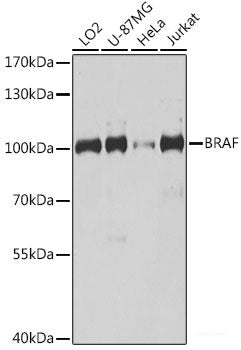 Immunofluorescence analysis of Hela cells using PLA2G4D Polyclonal Antibody at dilution of 1:100 (40x lens). Blue: DAPI for nuclear staining.