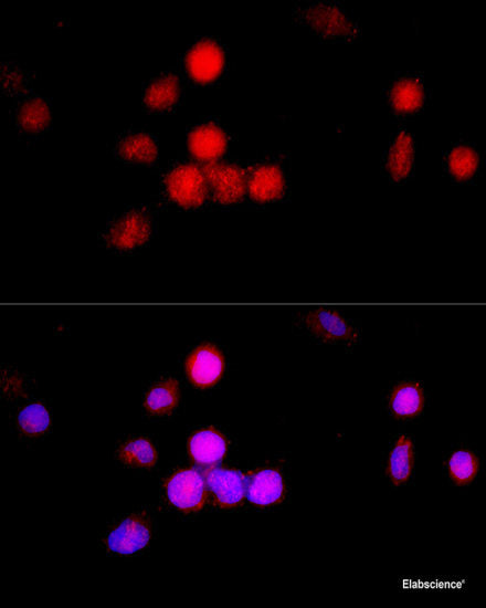Western blot analysis of extracts of various cell lines using VEPH1 Polyclonal Antibody at dilution of 1:1000.