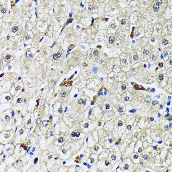 Immunohistochemistry of paraffin-embedded Rat lung using SUMO2 Polyclonal Antibody at dilution of 1:100 (40x lens).