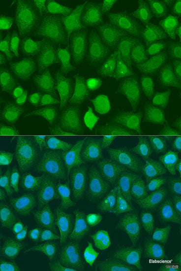 Western blot analysis of extracts of various cell lines using Acetyl-Histone H4-K5 Polyclonal Antibody at dilution of 1:1000. HeLa cells were treated by TSA (1uM) for 18 hours. C6 cells were treated by TSA (1uM) for 18 hours.