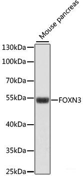 Immunohistochemistry of paraffin-embedded Rat brain using SLC6A3 Polyclonal Antibody at dilution of 1:200 (40x lens).