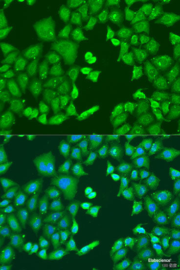 Immunofluorescence analysis of C6 cells using ARL1 Polyclonal Antibody at dilution of 1:100 (40x lens). Blue: DAPI for nuclear staining.