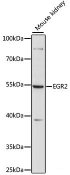 Immunohistochemistry of paraffin-embedded Rat heart using FLII Polyclonal Antibody at dilution of 1:100 (40x lens).