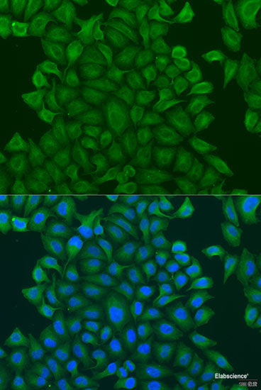 Immunohistochemistry of paraffin-embedded Rat heart using KCNJ15 Polyclonal Antibody at dilution of 1:100 (40x lens).