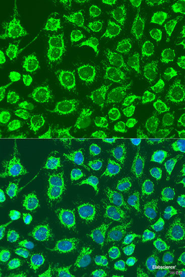 Western blot analysis of extracts of various cell lines using KIF5B Polyclonal Antibody at dilution of 1:1000.