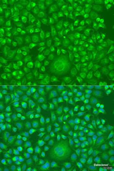 Immunohistochemistry of paraffin-embedded Human colon using KIF22 Polyclonal Antibody at dilution of 1:100 (40x lens).