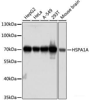Western blot analysis of extracts of various cell lines using MYH4 Polyclonal Antibody at dilution of 1:1000.