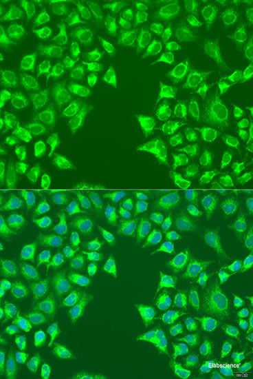 Immunohistochemistry of paraffin-embedded Rat liver using PFDN4 Polyclonal Antibody at dilution of 1:100 (40x lens).