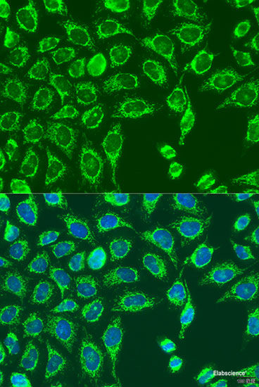Immunohistochemistry of paraffin-embedded Rat kidney using PLS1 Polyclonal Antibody at dilution of 1:100 (40x lens).