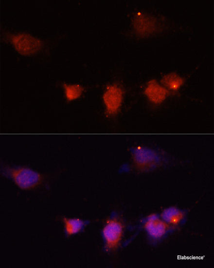 Immunofluorescence analysis of U-2 OS cells using ROBO1 Polyclonal Antibody at dilution of 1:100 (40x lens). Blue: DAPI for nuclear staining.