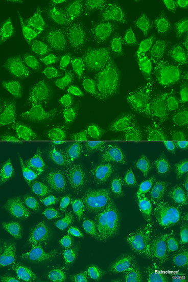 Immunohistochemistry of paraffin-embedded Human tonsil using S100A8 Polyclonal Antibody at dilution of 1:200 (40x lens).