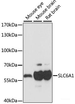 Immunohistochemistry of paraffin-embedded Rat heart using TRIP4 Polyclonal Antibody at dilution of 1:100 (40x lens).