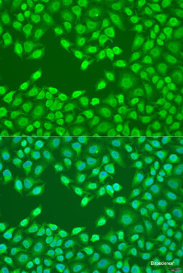 Immunofluorescence analysis of HeLa cells using VAV3 Polyclonal Antibody at dilution of 1:100. Blue: DAPI for nuclear staining.