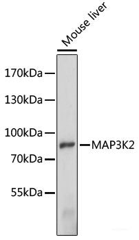 Western blot analysis of extracts of various cell lines using ESYT1 Polyclonal Antibody at dilution of 1:1000.