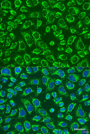 Immunofluorescence analysis of A431 cells using ACOT9 Polyclonal Antibody at dilution of 1:100. Blue: DAPI for nuclear staining.