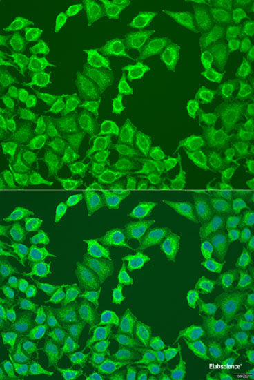 Immunohistochemistry of paraffin-embedded Rat ovary using KANK2 Polyclonal Antibody at dilution of 1:100 (40x lens).
