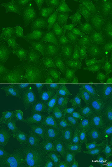 Immunohistochemistry of paraffin-embedded Rat brain using AK5 Polyclonal Antibody at dilution of 1:100 (40x lens).