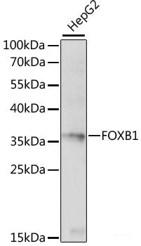 Immunofluorescence analysis of U-2 OS cells using SULT1C4 Polyclonal Antibody at dilution of 1:100. Blue: DAPI for nuclear staining.