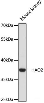Western blot analysis of extracts of various cell lines using TRNAU1AP Polyclonal Antibody at dilution of 1:1000.