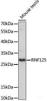 Western blot analysis of extracts of various cell lines using ZNF331 Polyclonal Antibody at dilution of 1:1000.