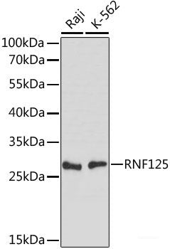 Immunofluorescence analysis of C6 cells using DDX24 Polyclonal Antibody at dilution of 1:100. Blue: DAPI for nuclear staining.