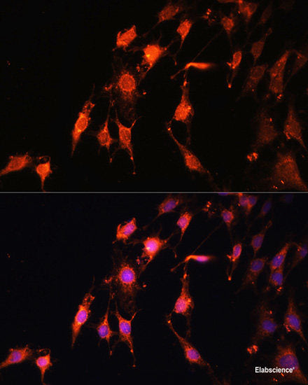 Immunofluorescence analysis of U-2 OS cells using RBM25 Polyclonal Antibody at dilution of 1:100. Blue: DAPI for nuclear staining.