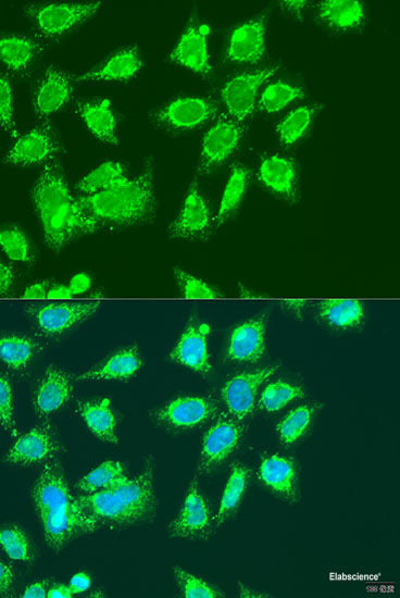 Western blot analysis of extracts of Rat eye using RTBDN Polyclonal Antibody at dilution of 1:1000.
