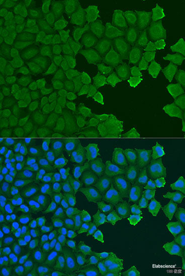 Immunofluorescence analysis of C6 cells using HOPX Polyclonal Antibody at dilution of 1:100. Blue: DAPI for nuclear staining.