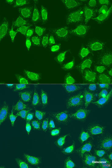 Immunofluorescence analysis of Rat testis using TPD52L3 Polyclonal Antibody at dilution of 1:100. Blue: DAPI for nuclear staining.