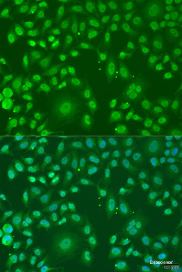 Western blot analysis of extracts of C6 cells using CAV1 Polyclonal Antibody at dilution of 1:1000.